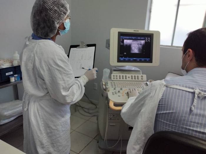 HDS é pioneiro em escleroterapia com espuma densa pelo SUS em Goiás