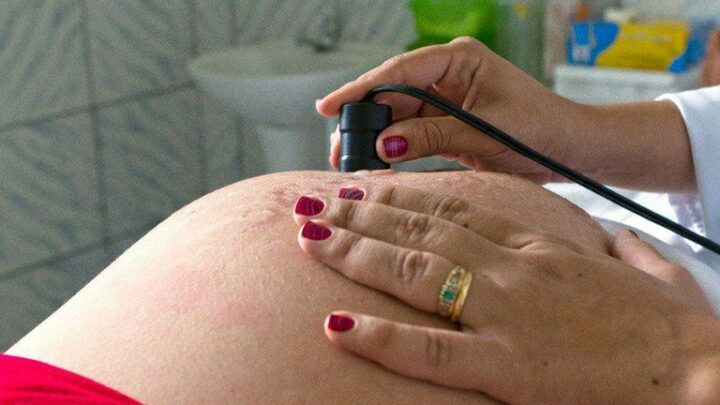 Rede Cegonha: R$ 6,7 milhões são destinados para exames de pré-natal