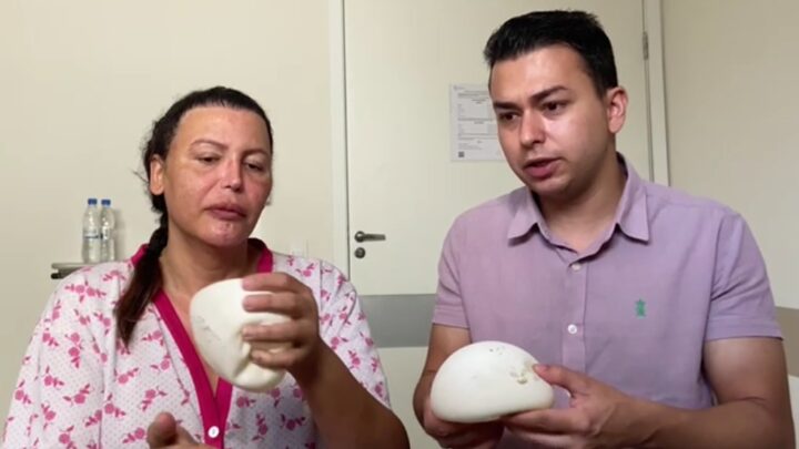Cirurgião Thiago Marra atualiza o estado de saúde da despeitada Luiza Marilac e faz alerta sobre o uso do silicone industrial